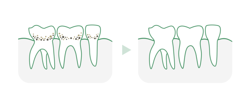 Dentální hygiena