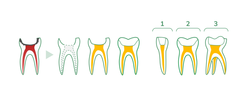 Endodoncie