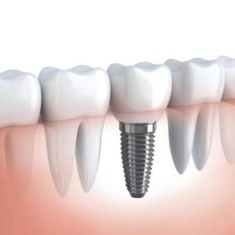 Implantology